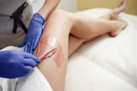 Depending on the level of hair growth, hard wax hair removal lasts: Waxing Hair Removal Le Boudoir Institut Taipei èŠ™æ´›åŠ
