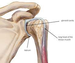 A posterior tear of the posterior labrum is known as a posterior labral sublabral foramen are anatomical variants, which is where the labrum can be 'lifted up' between 12 and 3 o'clock. Shoulder Labrum Tear Polaris Pt Wellness