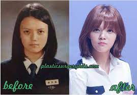 Reconstructive jimin aoa plastic surgery helps to eliminate defects in organs and restore their functions. Aoa Shin Jimin Plastic Surgery Aoa Shin Jimin Plastic Surgery Fact Or Rumor Kpop Plastic Surgery