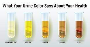 Air kencing warna putih jernih apakah sehat. 7 Jenis Warna Urine Dan Artinya Bagi Kesehatan Idn Medis