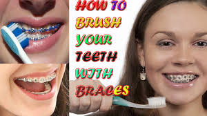 We also include a travel toothbrush, perfect for bringing to work or school. How To Brush Your Teeth With Braces Easy Way To Brush Your Teeth With Braces Properly How To S Youtube