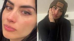 Jessica Cediel le responde a quienes se 'alegran' por su delicado estado de  salud | Red+ Noticias 15 Minutos