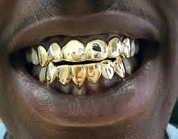 Dayyani jewelers makes gold grillz shopping smooth and easy, while offering the best hand. Gold Grillz Miami On Twitter 6 6 10k Solid Yellow Gold Grillz High Quality Heavy Call Text 305 989 6479 To Make Yours Grillz Goldgrillz Solidgold Customgrillz Https T Co Jsewkphv6p