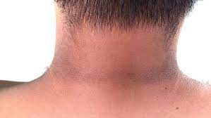 Lho, katanya mau kencing? katanya sambil tersenyum dan kembali memandang junior saya yang sudah naik tinggi. Awas 12 Perubahan Kulit Ini Tanda Gejala Diabetes