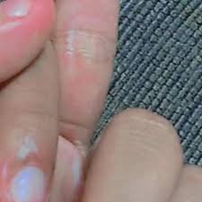 Here are many translated example sentences containing tangan berdarah . Discover Tangan Berdarah Kaca S Popular Videos Tiktok