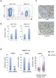 Valoarea francului in raport cu celelalte valute este in primul rand stabilita de raportul cerere/oferta, declara economistul aurelian dochia. Ribophorin Ii Regulates Breast Tumor Initiation And Metastasis Through The Functional Suppression Of Gsk3b Scientific Reports
