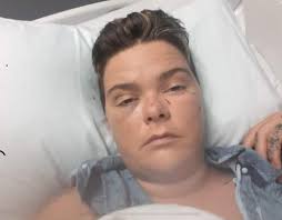 AR woman loses part of intestine after attack