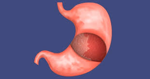 Pin En Salud