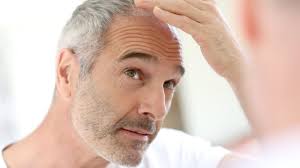 Understanding how hair grows and regenerates can hormonal imbalances due to perimenopause or polycystic ovarian syndrome (pcos) are the. Poliklinika Pantovcak Hair Clinic Causes Of Hair Loss