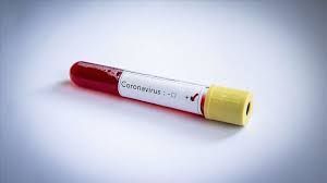 Before you get to your appointment. Switzerland Reports First Death From Covid 19