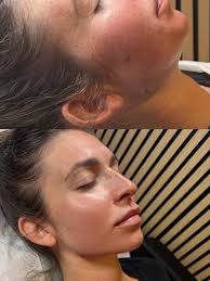 ✨ CHEEKS • JAWLINE • SKIN BOOSTERS ✨ Ready to LEVEL UP your facial contour?  Our Cheeks, Jaw & Skin Booster Contour Package is designed to sculpt,  define, and GLOW from every