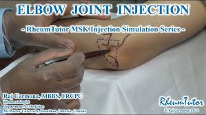 Image result for Elbow Joint Injection