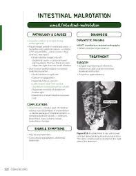 Image result for Intestinal Malrotation