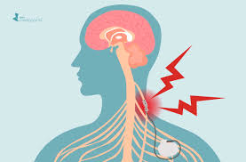 The vasovagal response is an automatic reflex that stimulates your vagus nerve. Understanding Neuromodulation And Vagus Nerve Stimulation For Rheumatoid Arthritis