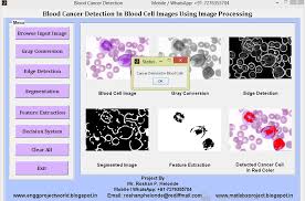 Blood cancers may be detected using this. Engineering Projects Leukemia Blood Cancer Detection Using Image Processing Matlab Project Code