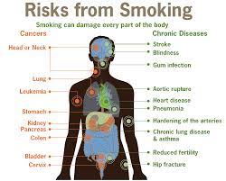 Health Effects Of Tobacco Wikipedia
