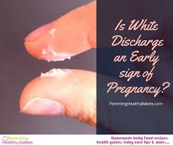 Normal discharge during the third trimester of pregnancy. Pin On My Saves