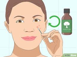 Tea tree oil for cystic acne. How To Use Tea Tree Oil For Acne 12 Steps With Pictures