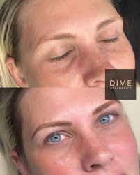 ISO a great tattoo artist. Wanting to get a cover up done 🙌