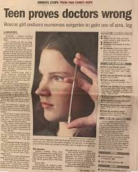 Rare Disease Day 2021. Never give up. #rarediseaseawareness  #rarediseaseday2021 #olliersdisease #fyp #iamrare #showyourstripes