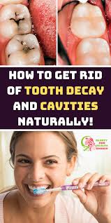 Check spelling or type a new query. How To Get Rid Of Tooth Decay And Cavities Naturally Dental Decay Tooth Decay Oral Care