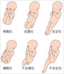 逆子体操の効果を上げるために押さえておきたいコツ 赤ちゃんようこそ com drawing reference poses drawing reference drawings