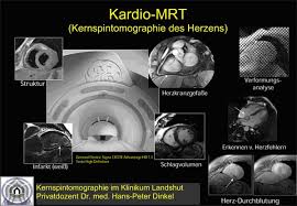 Die entzündungswerte im blut können ebenfalls aufschluss geben. Kardio Mrt Privatinstitut Fur Kernspindiagnostik