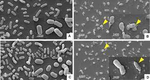 Box 6100, mississippi state, mi 39762, usa. Scanning Electron Micrographs Of Listeria Innocua And Bacillus Subtilis Download Scientific Diagram