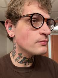 5 month healed facial scar by Chase Campbell : r/bodymods