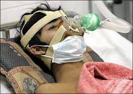 Less severe symptoms can also include eye infections. Bird Flu Capable Of Human To Human Infection