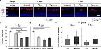 Discover and save on 1000s of great deals at nearby restaurants, spas, things to do, shopping, travel and more. Frontiers Novel Porcine Retina Cultivation Techniques Provide Improved Photoreceptor Preservation Neuroscience