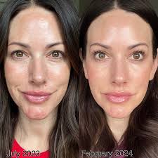 Is the Boogie Micro-Mist Saline Inhaler in your medicine cabinet?