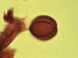 Image result for Anthonotha macrophylla