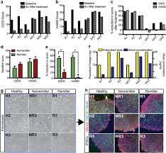 Ssris (selective serotonin reuptake inhibitors) such as prozac, paxil and zoloft revolutionized the treatment of depression and related disorders when they arrived on the market in the 1980s. Serotonin Induced Hyperactivity In Ssri Resistant Major Depressive Disorder Patient Derived Neurons Molecular Psychiatry