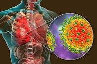 Nipah Virus:भाटी साहब की चकाचक गांड  वाली मस्त मस्त बेटी  सुचेरीता कुकरेती हिमानी नैथानी श्वेता सिंह अंजना ओम कश्यप कि चूतों का गणपति के पहले नक्सली स्थापना सप्ताह 21 से 27 सितंबर 2023 से खुद की पोद  खुद धोने का नया षड्यंत्रवायरस: ये लक्षण ...