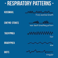 Image result for Respiratory Rate