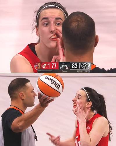 Caitlin Clark got hit in the mouth while her and Jewell Loyd were going for  a defensive rebound. Clark remained in the game.