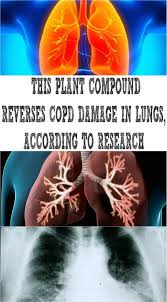 This Plant Compound Reverses Copd Damage In Lungs According To Research Asthma Treatment Copd Chronic Obstructive Pulmonary Disease
