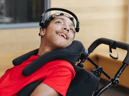 It's time we dare to think differently about disability