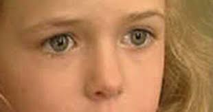 Cô bé sống với nửa bộ não