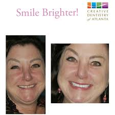 If you're looking for a dental visit that feels easy, comfortable, and  welcoming, we'd love to take care of you. Contact us for full details.  #dentistatlantaga #sandyspringsdentist #alpharettadentist #atlantadentist  #dentalcleaning #teethcleaning ...