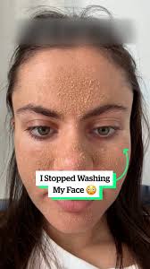 I stopped washing my face to rebuild my natural skin barrier 😲
