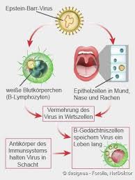 War auch zuerst beim kinderarzt mit ihr, der ihr lediglich antibiotika verschrieb, die natürlich gar nicht. Pfeiffersches Drusenfieber Symptome Ansteckung Verlauf Netdoktor