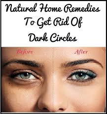 How To Get Rid Of Dark Circles Under Eyes Natural Home Remedies Dark Circles Under Eyes Dark Spots Under Eyes Dark Circles Treatment