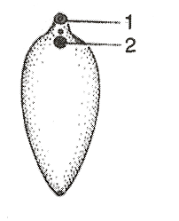 To identify the proteins present in all periods of infection with f. A Identify The Organism Br B Label The Part 1 And 2 Br