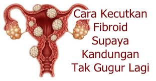 Namun, studi terbaru menunjukkan bahwa kondisi ini terlihat berdampak pada tingkat implantasi dan kehamilan klinis, meskipun kurang signifikan dibanding fibroid submukosal. Vitamin Untuk Kecikkan Fibroid Dan Cyst