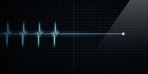 1,000+ Heart Monitor Dead Stock Photos, Pictures & Royalty-Free Images -  iStock | Flat line