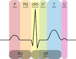 It is a graph of voltage versus time of the electrical activity of the heart using electrodes placed on the skin. Datei Ekg Komplex Svg Wikipedia