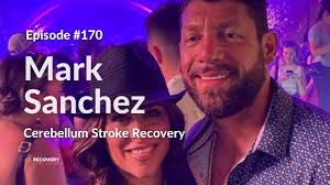 Cerebellum Stroke Recovery