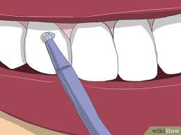 Wisdom tooth pain is another common dental problem which you can usually help relieve at home. How To Apply Tooth Gems 14 Steps With Pictures Wikihow